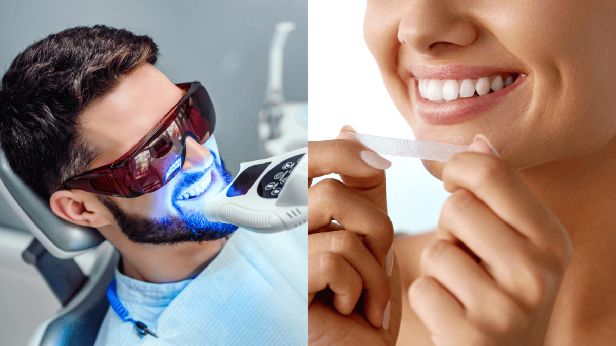 Professional-vs.-Home-Teeth-Whitening-1200x675.png